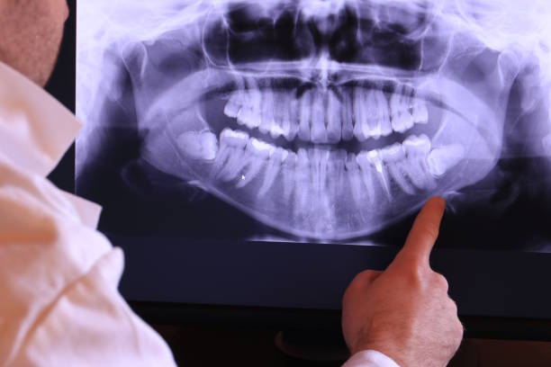 Best Emergency Treatment for Dental Infections or Abscesses in Hope Mills, NC