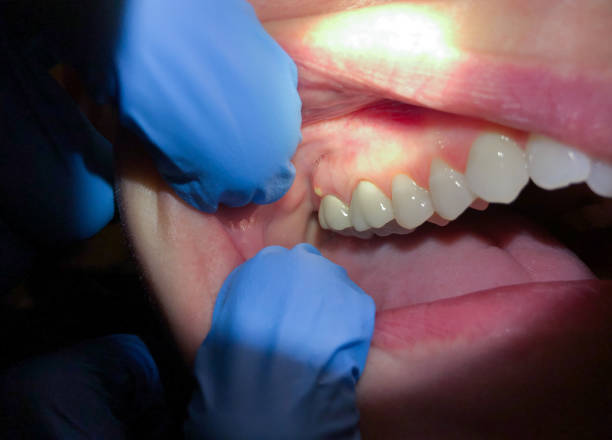 Best Weekend Emergency Dentist in Hope Mills, NC
